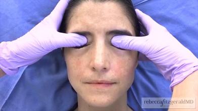 Basic clinical dermatology dimensional facial sculpting three