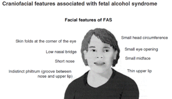 Alcohol damages facial recognition