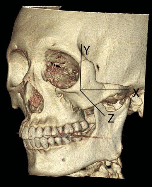 best of Skeleton Cranio facial