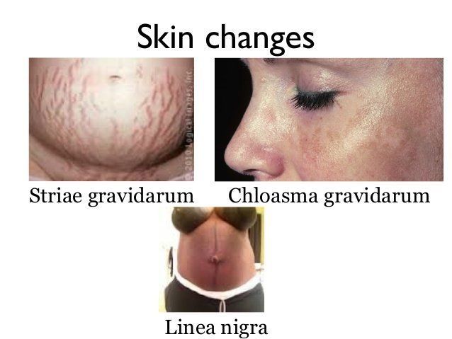 Lele reccomend Changes to vagina during pregnancy