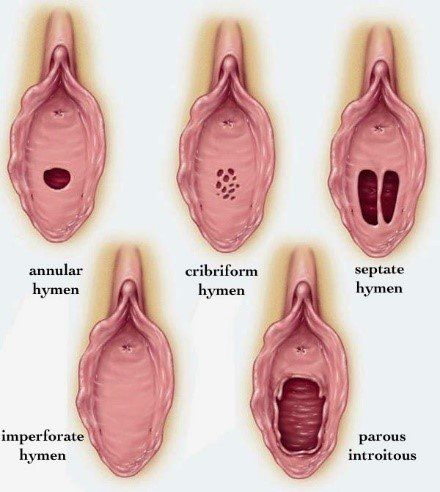 Hymen virginity picture