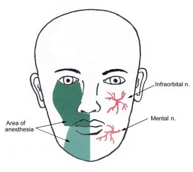 Snowdrop reccomend Facial lacerations repair emedicine