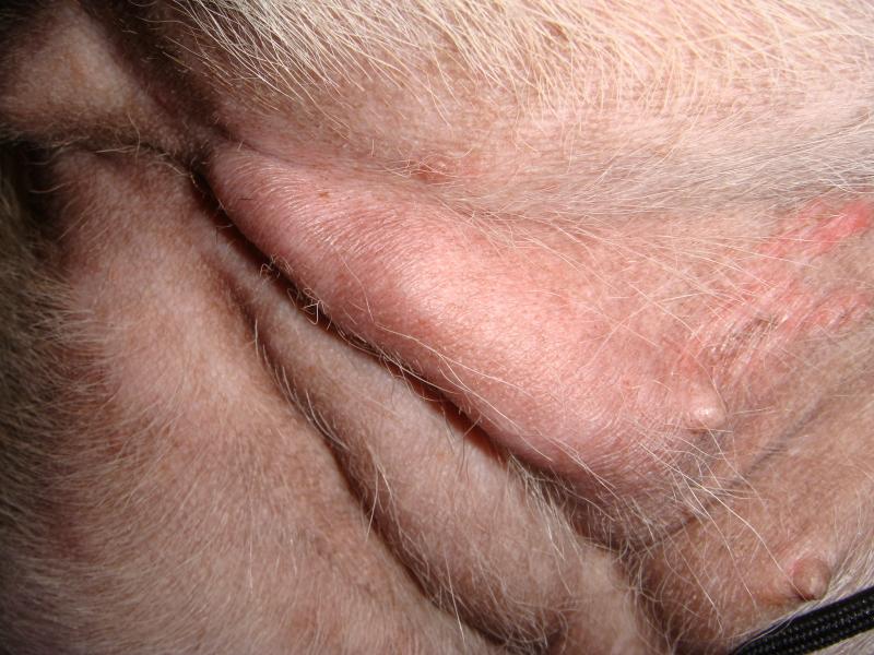 Bump under skin of vagina