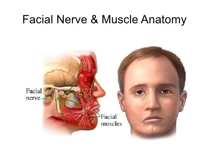 best of Facial nerve stimulation Electrical
