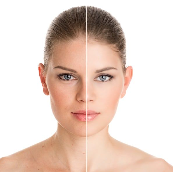 Queen C. reccomend Example of facial rejuvenation ad online