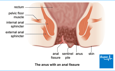 Anal affects questions