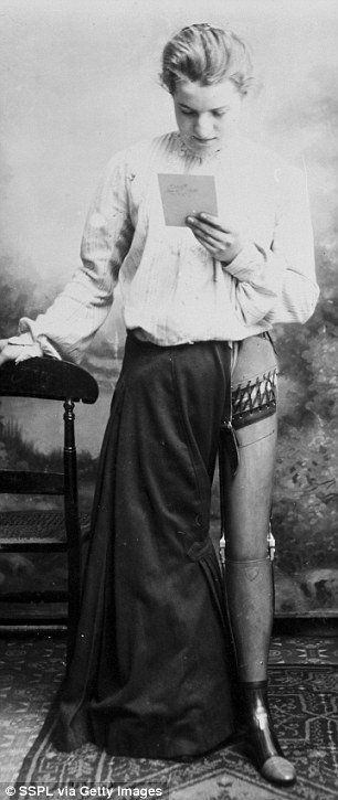 best of Girl with artificial legs 1890