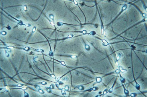 Sperm fertility microscope