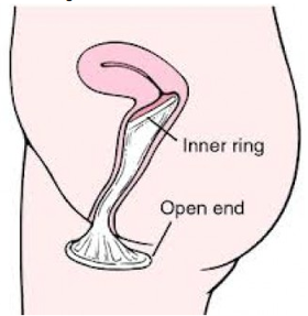 Nut reccomend Condom inside vagina