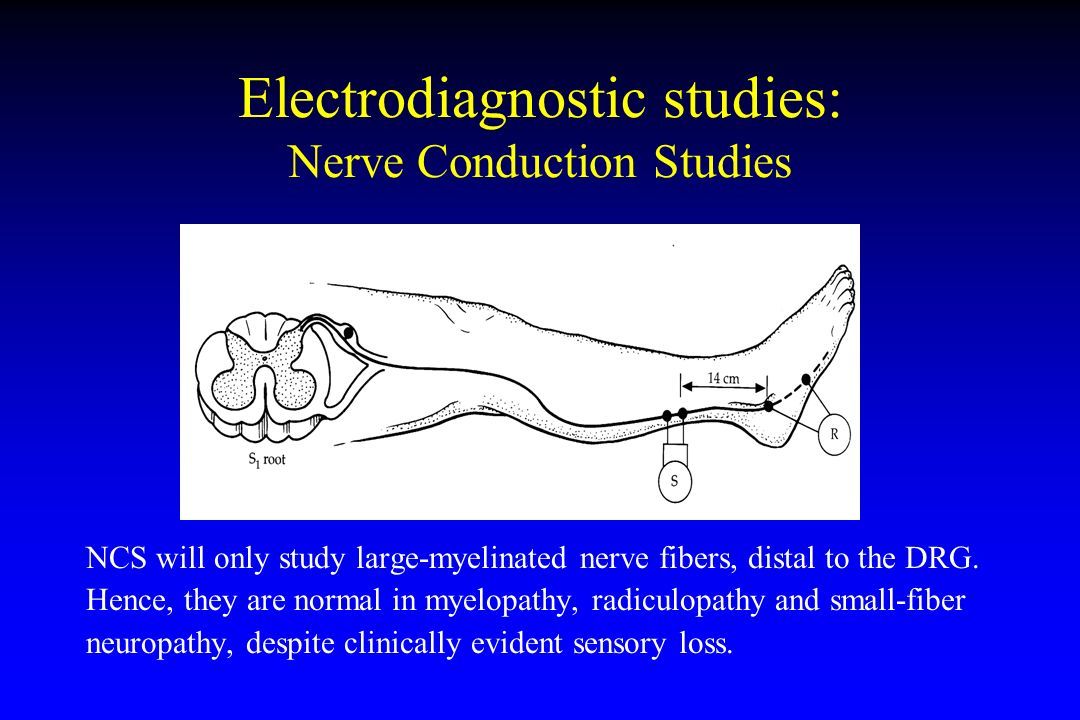 Nerve conductive studies facial