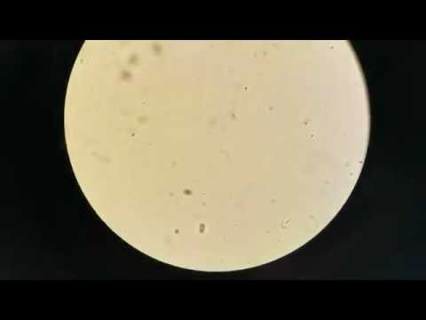 HQ reccomend Sperm in urine microscope