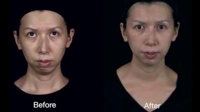 Vulture reccomend Basic clinical dermatology dimensional facial sculpting three