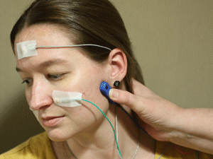 Electrical facial nerve stimulation