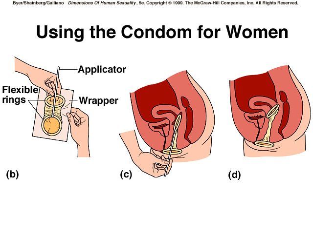 Combat reccomend Condom inside vagina