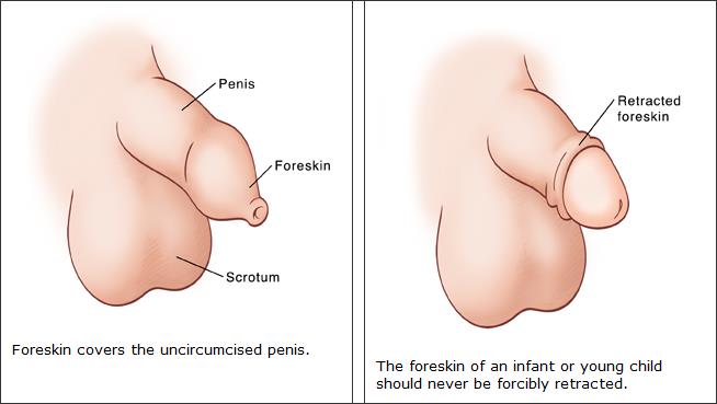 Gallery of uncircumcised penis