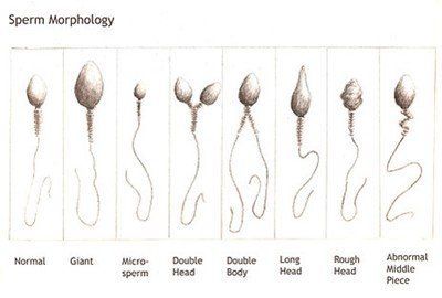 Boomer reccomend Sperm fertility microscope