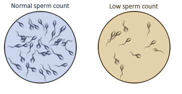 Sperm fertility microscope