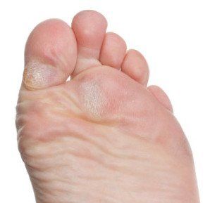 Bottom of toe