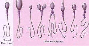 best of Morphology cures Sperm