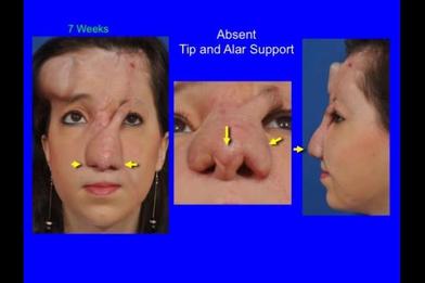 best of Reconstruction Microsurgical facial