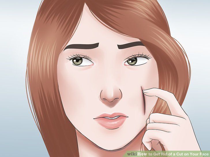 Avoiding facial scars