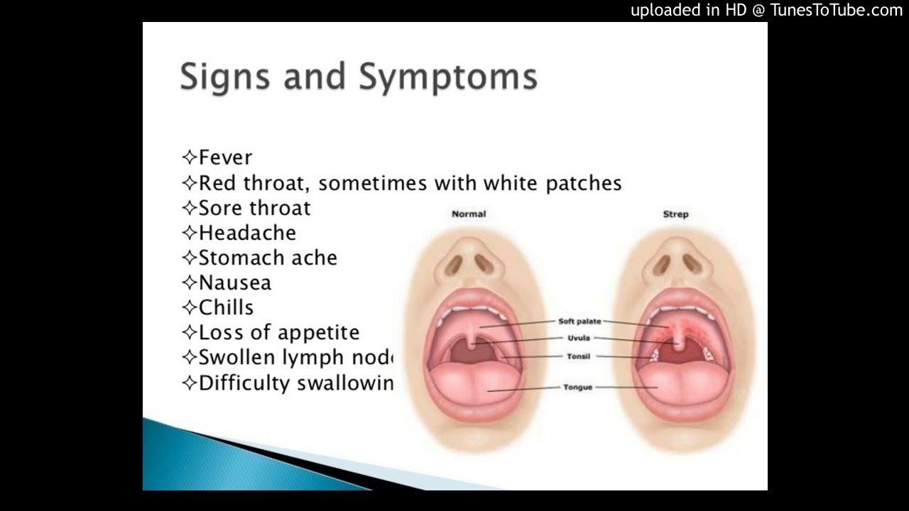 best of Strep b infection adults Symptoms