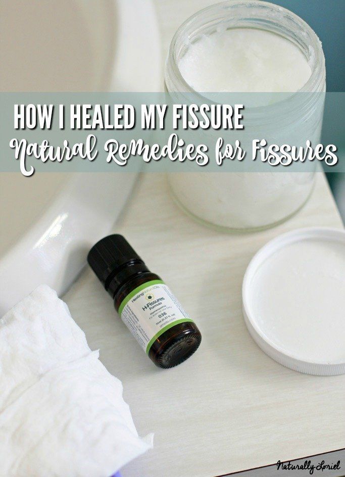 Anal fissure herbal treatment
