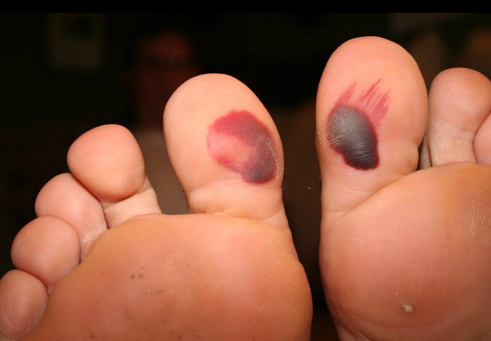 Bottom of toe