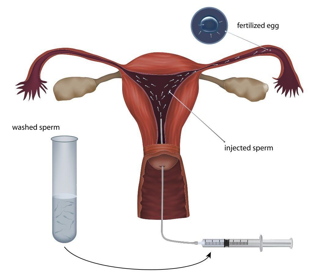 Seeking surrogate mother sperm donor