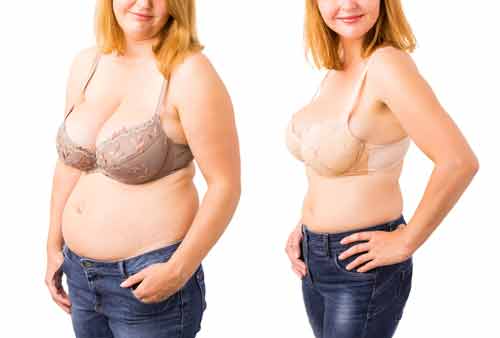 best of Reduction surgery breast Of