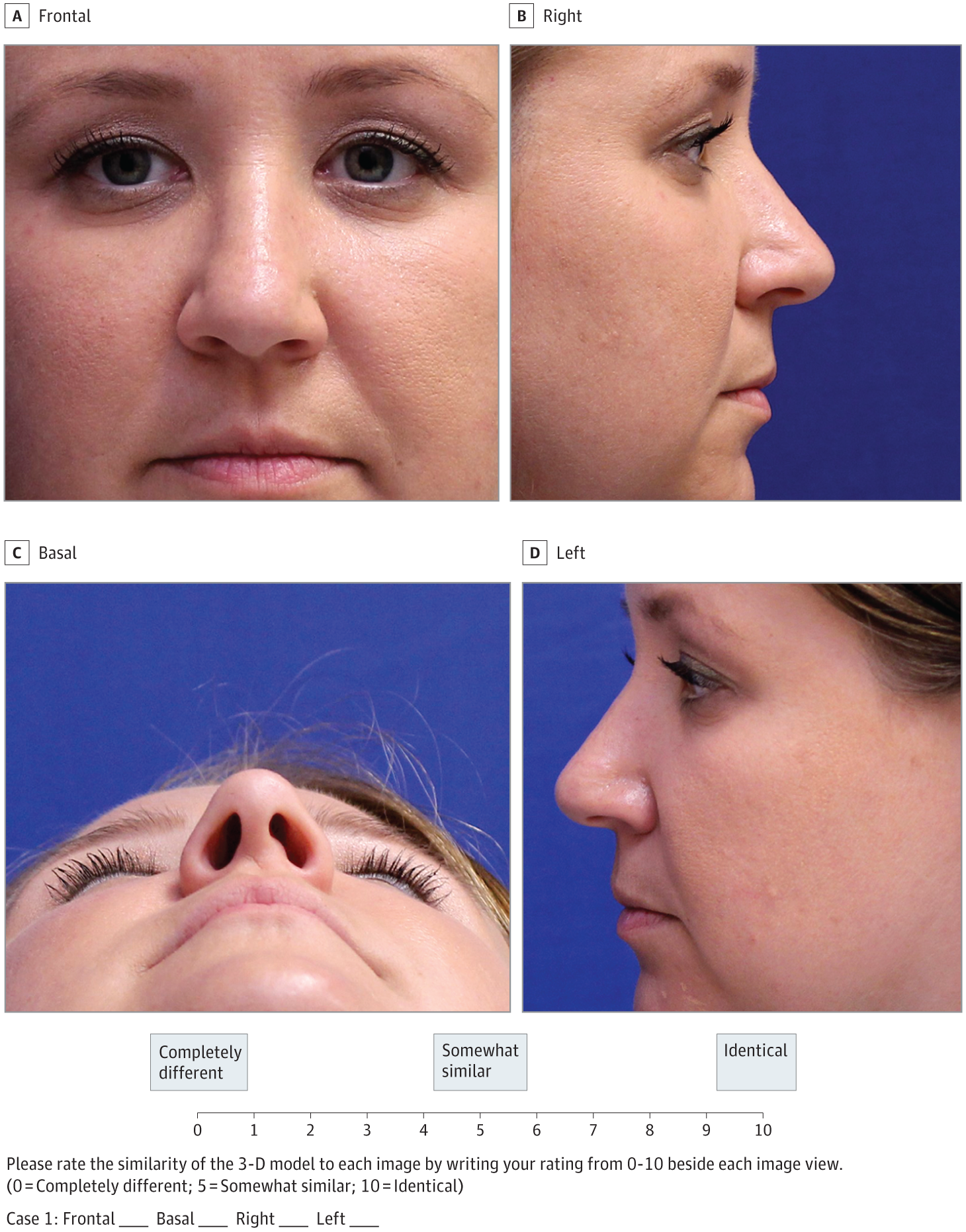 best of Clinical dermatology facial three sculpting dimensional Basic