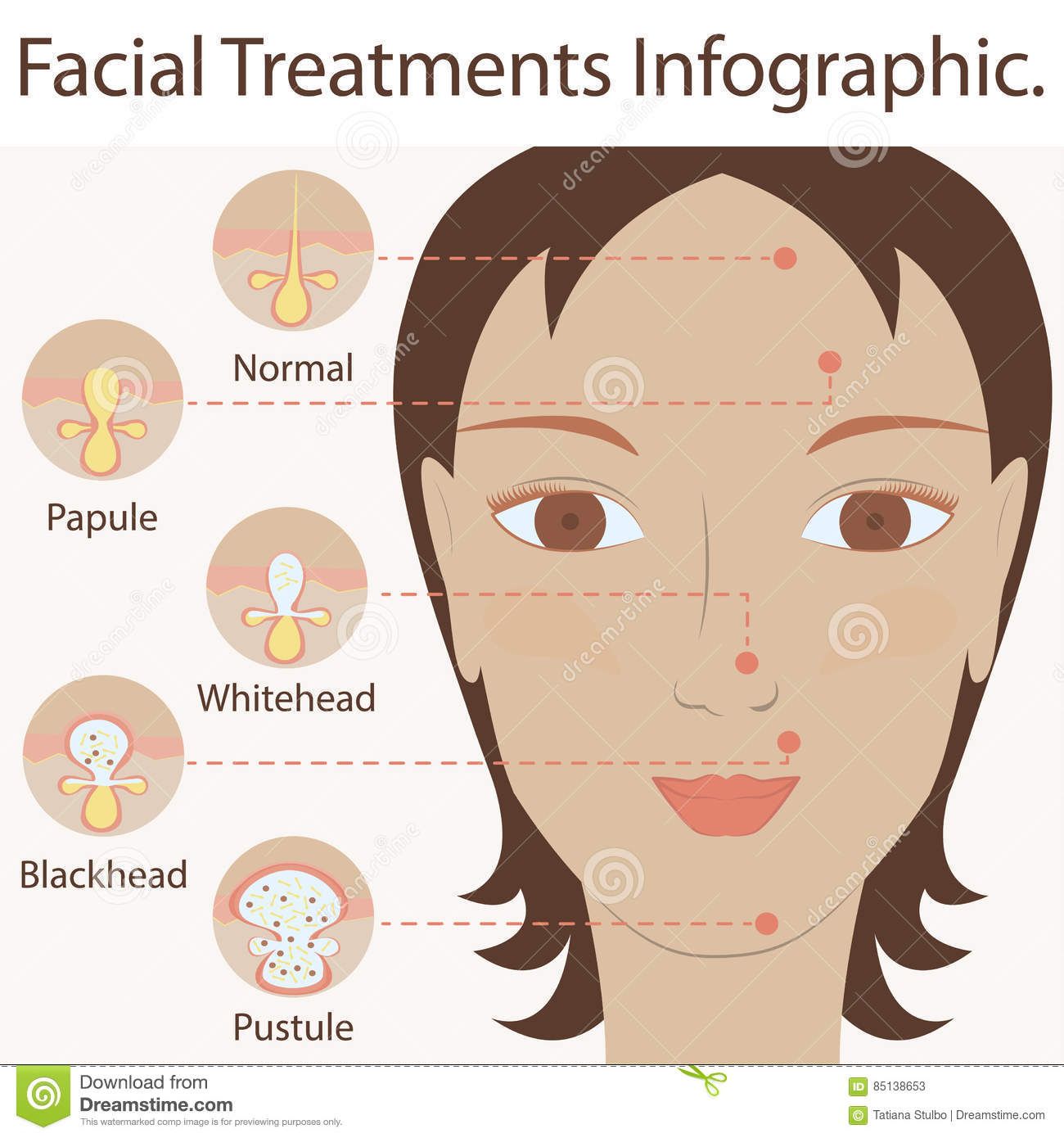 best of Growth types Facial