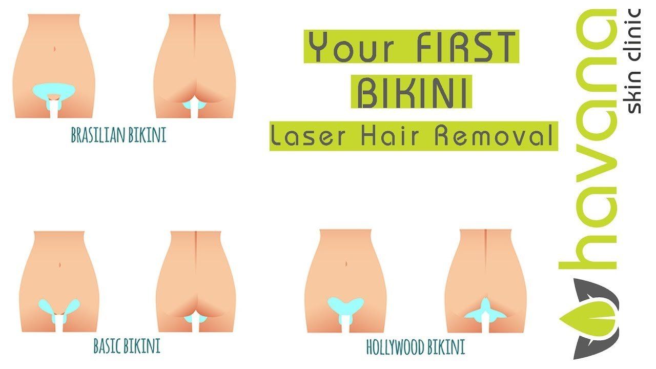 best of Hair removal vs bikini Laser waxing
