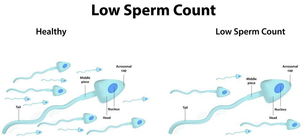 Doodle reccomend Low sperm ejaculate
