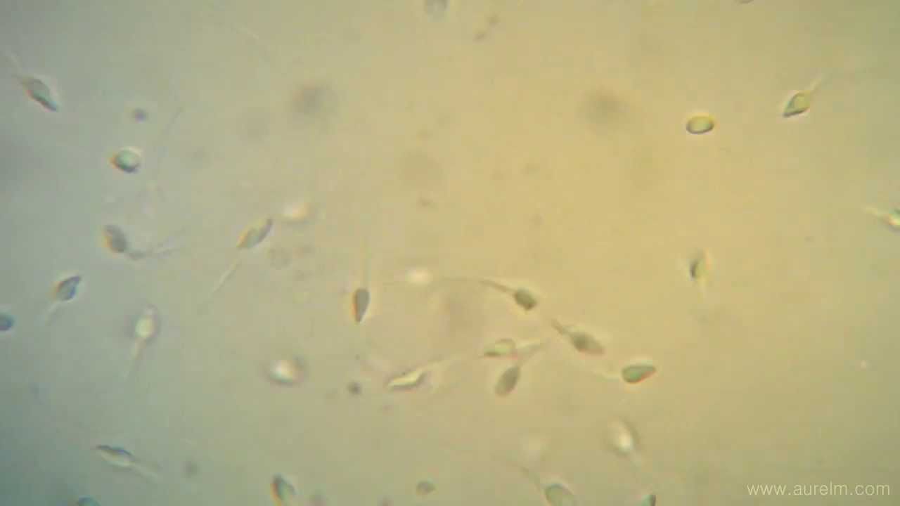 Microscope and sperm