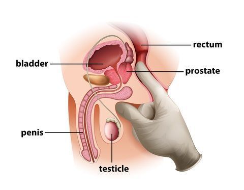 best of Pics Prostate orgasm