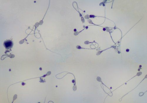 best of Microscope Sperm fertility
