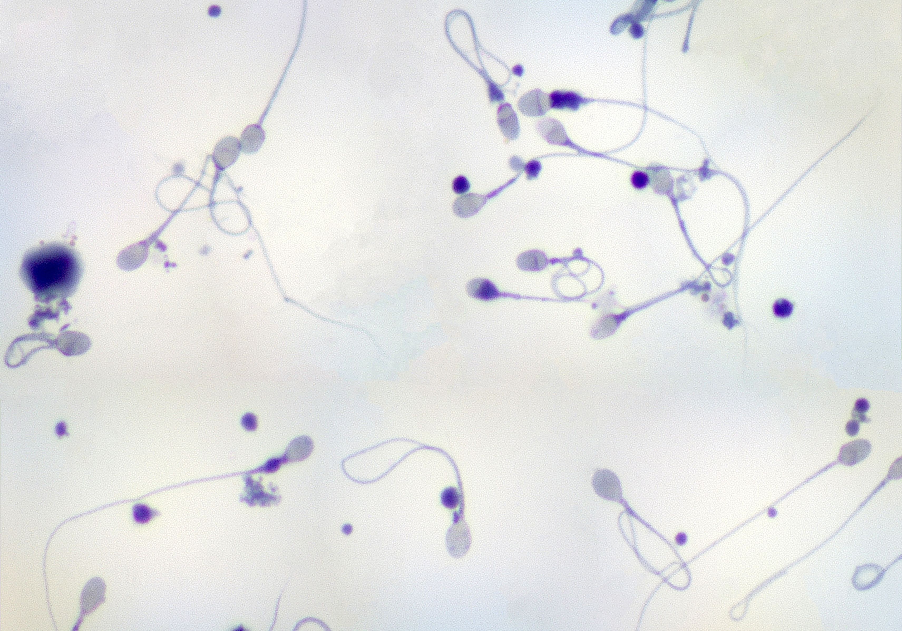Sperm morphology cures